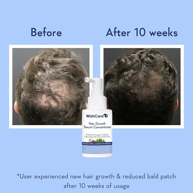 WishCare Hair Growth Serum Concentrate - 3% Redensyl, 4% Anagain, 2% Baicapil, Caffeine, Biotin & Rice Water - Advanced Hair Growth Serum for Hair Fall Control & Hair Growth 30ml